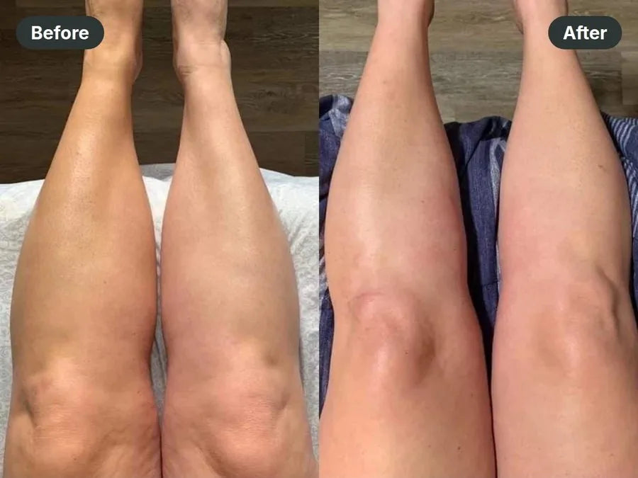 Before and after: thighs & knees