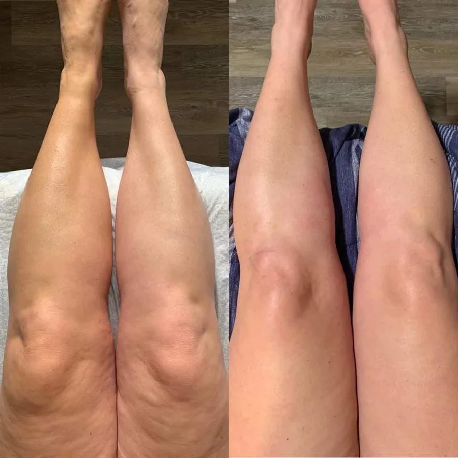Before and after, legs from above