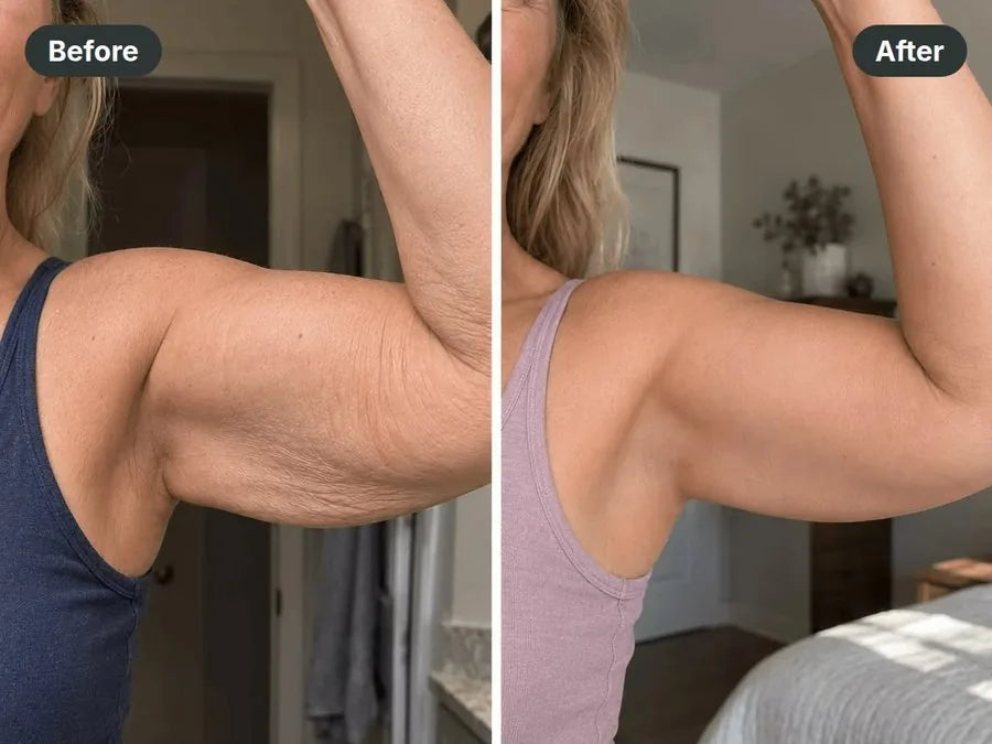 Before and after: back of the upper arm