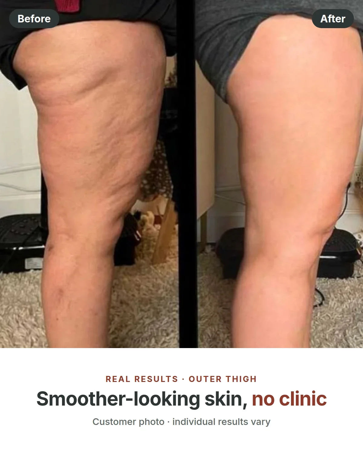 Before and after, smoother-looking skin