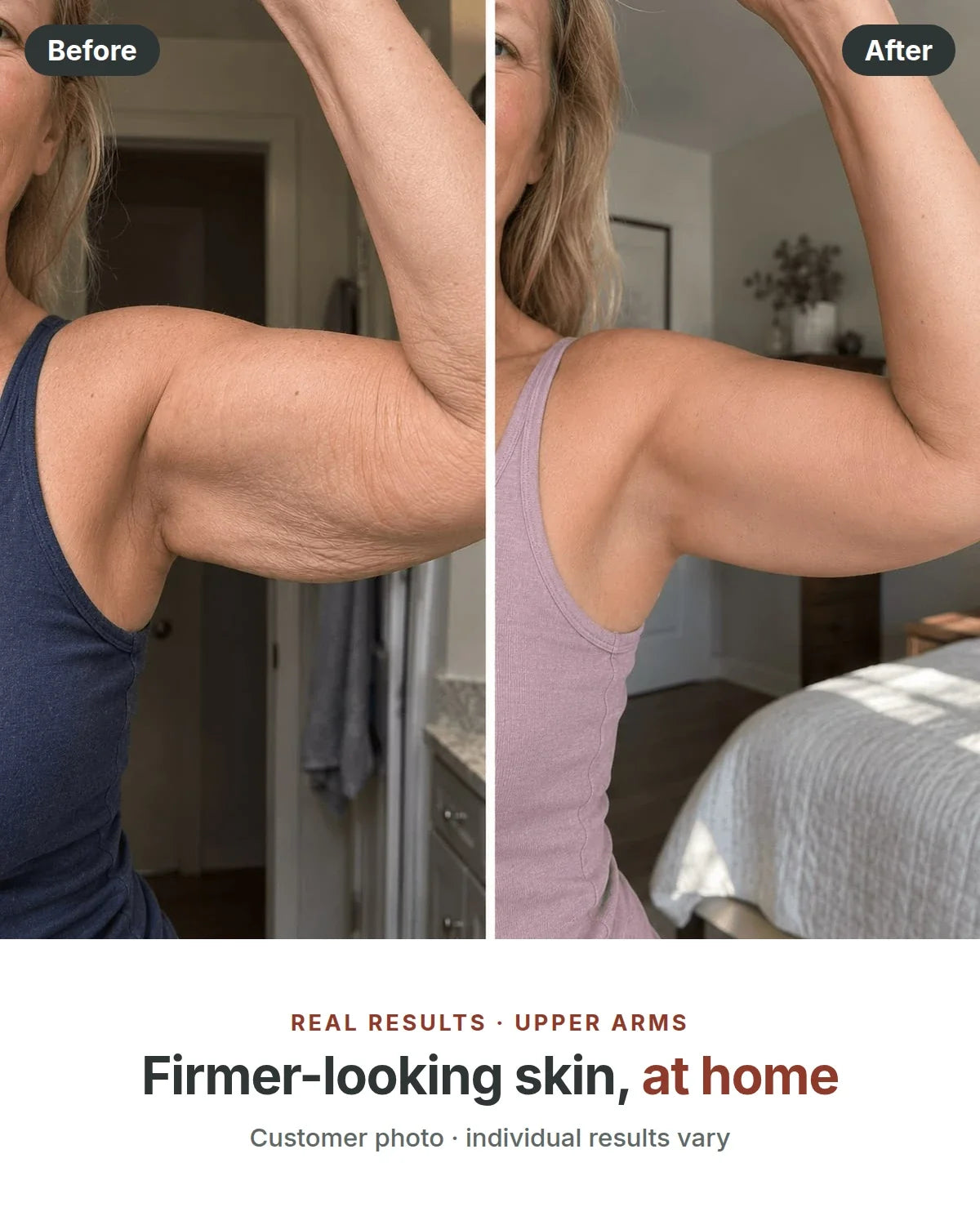 Before and after: upper arms, firmer-looking skin