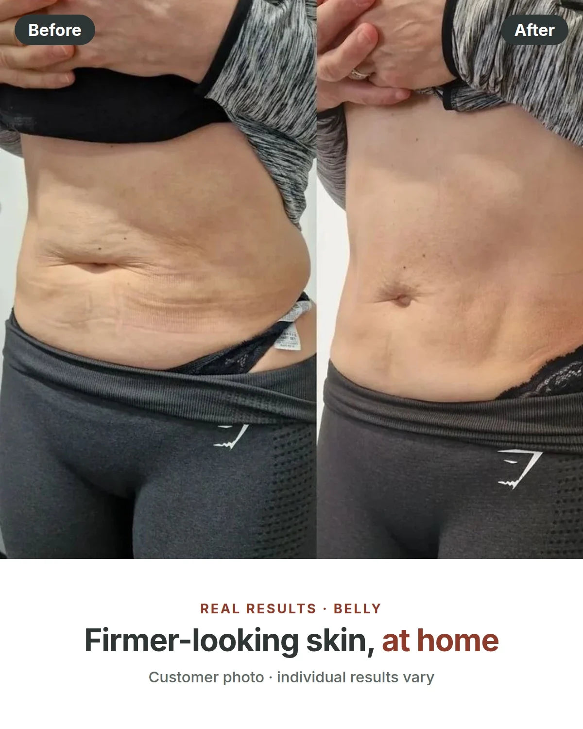 Before and after, firmer-looking skin
