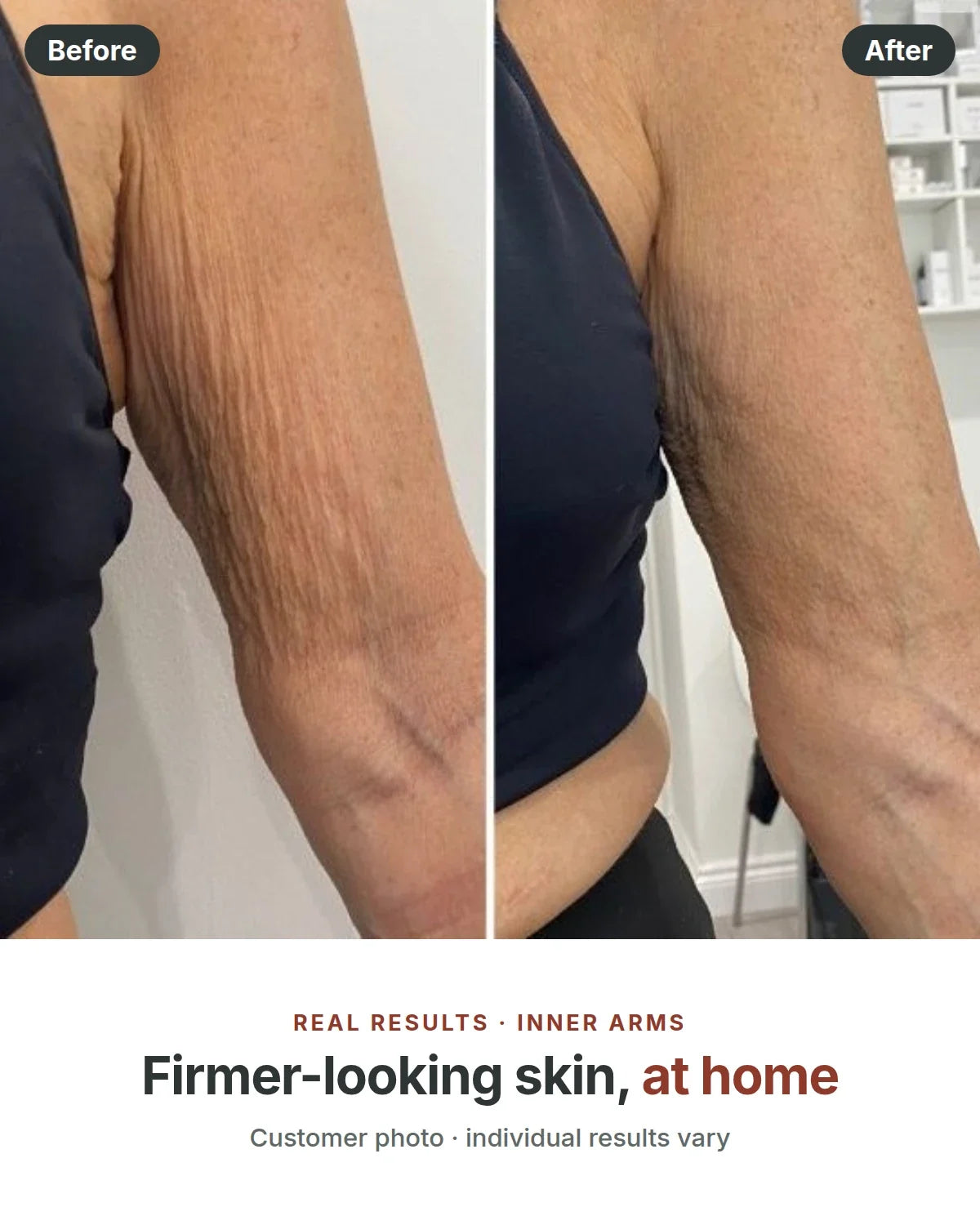 Before and after, firmer-looking skin